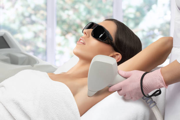laser hair removal